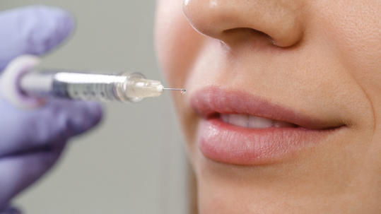 Dermal fillers injected to a woman’s lips for anti-aging treatment